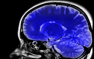 brain health and disease