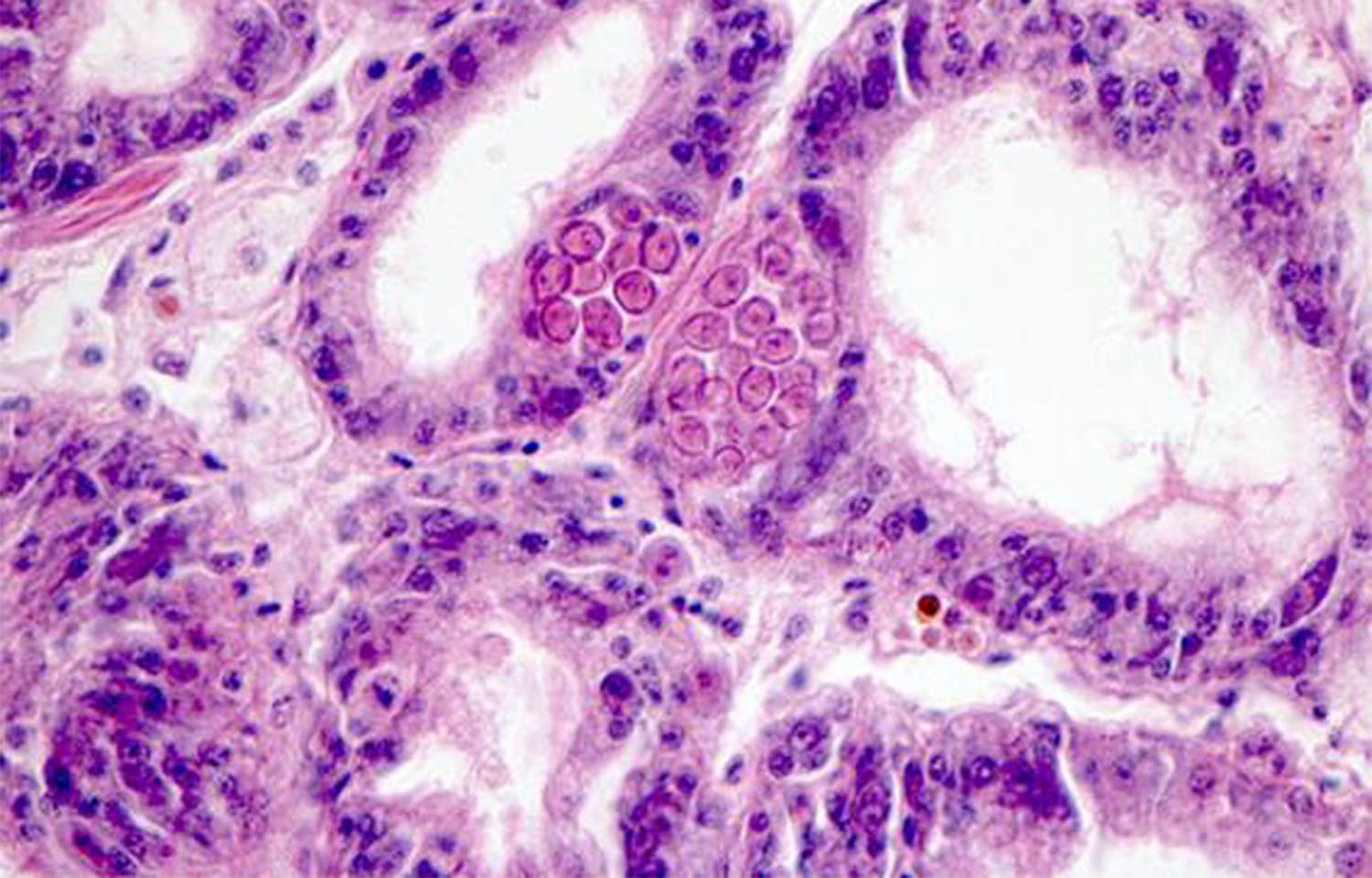 A microscopic view of the effects of MSX on oysters