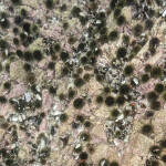 Sea urchins in Norway
