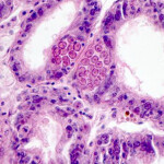 A microscopic view of the effects of MSX on oysters