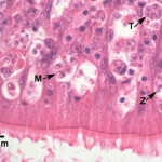 An image showcasing a heavy Dermo infection